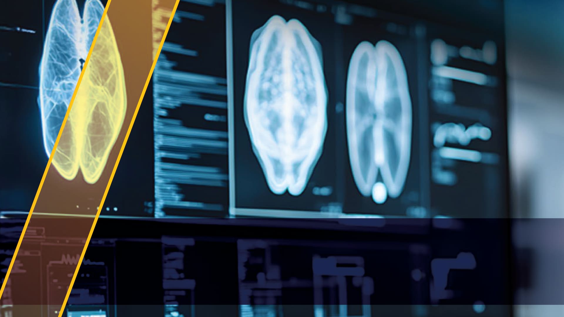 Modern MRI Radiology Diagnostic Room - Lear Medical